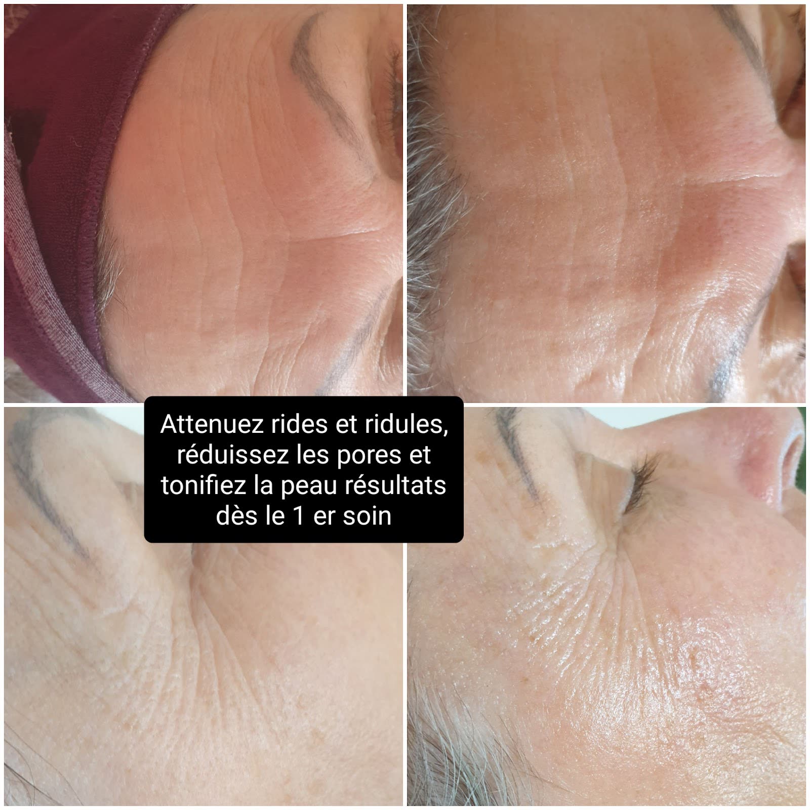 Photos avant et après d'un soin du visage